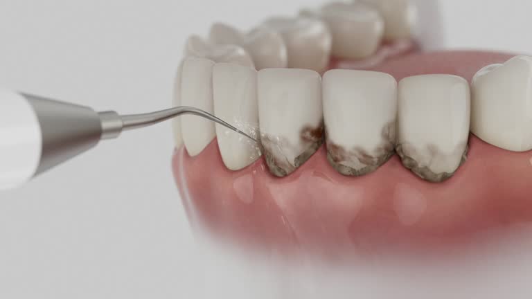 Trusted Dental Implants service in Roseville, CA - Dentist Open Now